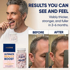 Moerie Hair Boost Supplements for Hair Skin Nails

