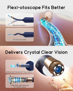 Bebird Ear Wax Removal Tool with Camera Otoscope

