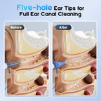 Electric Ear Cleaning Kit with Light for Ear Wax Removal

