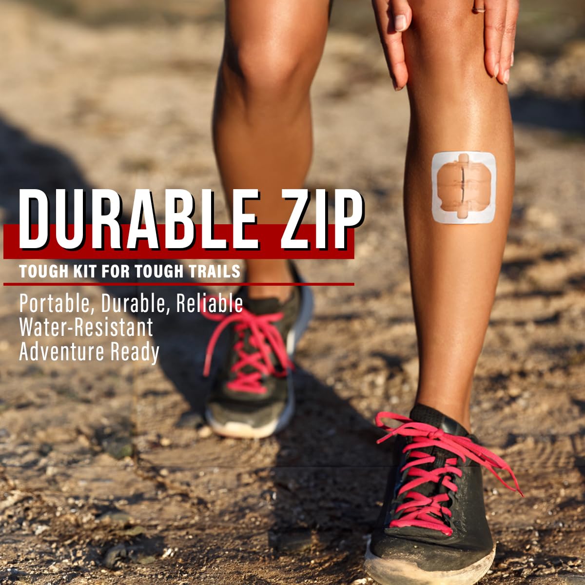 EVERLIT Wound Closure System | Suture-Free Zip-Stitch

