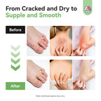 SAVILAND Antifungal Cream Maximum Strength Tea Tree Oregano

