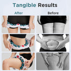 Cellulite Massage Tool - Lymphatic Roller for Legs

