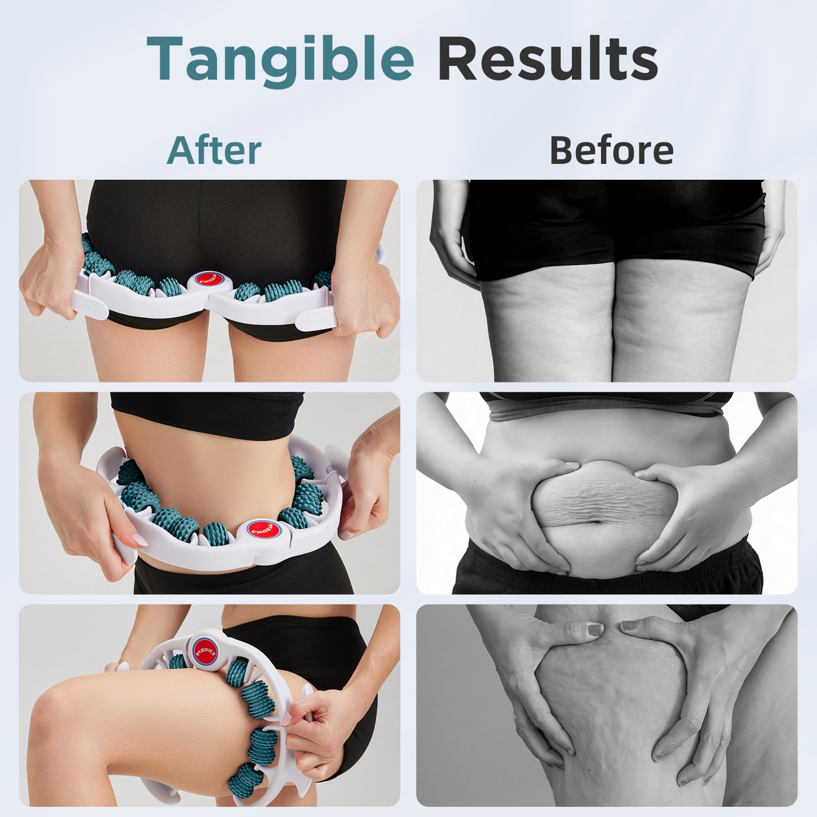 Cellulite Massage Tool - Lymphatic Roller for Legs

