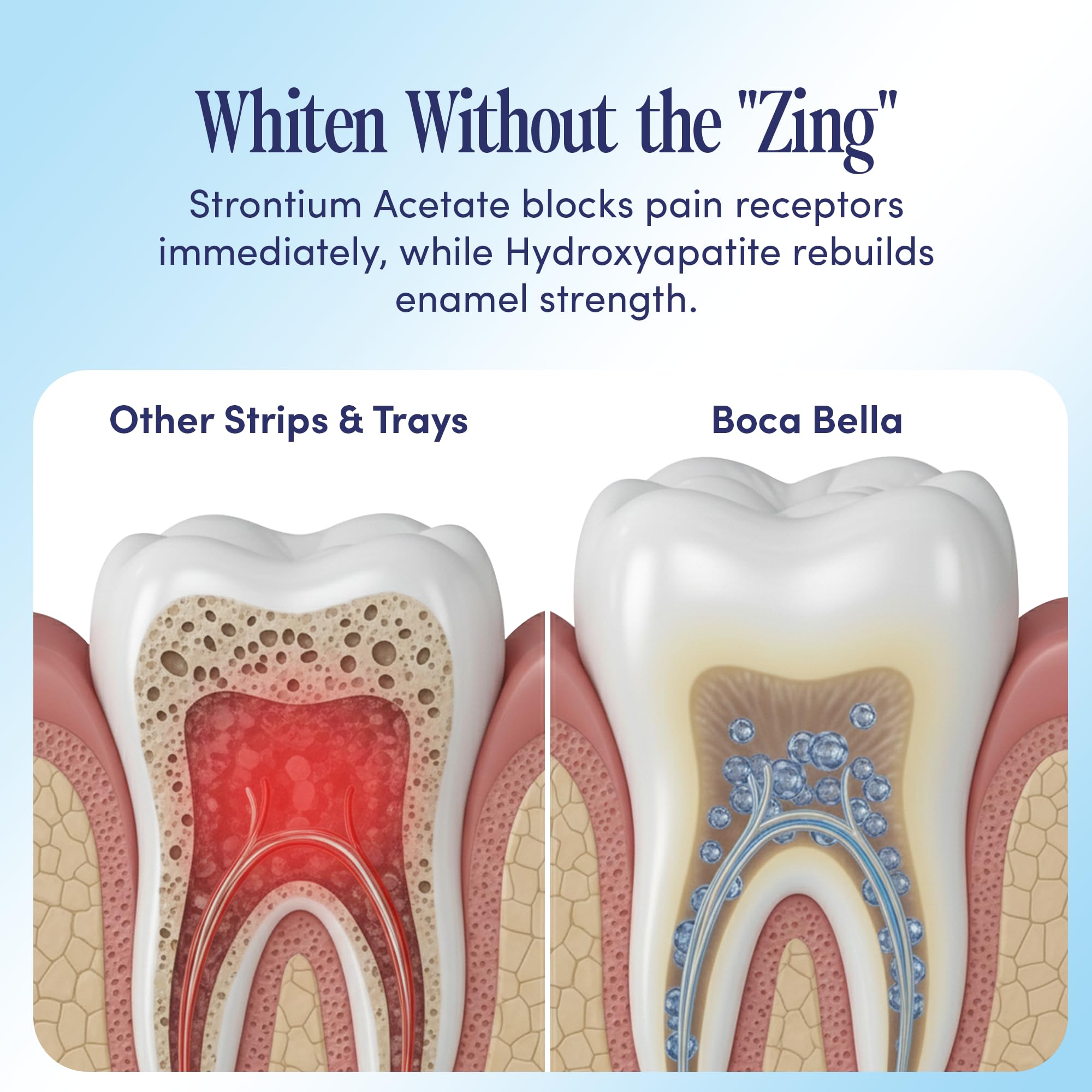 BocaBella Teeth Whitening Trays U-Wraps Enamel-Safe Formula

