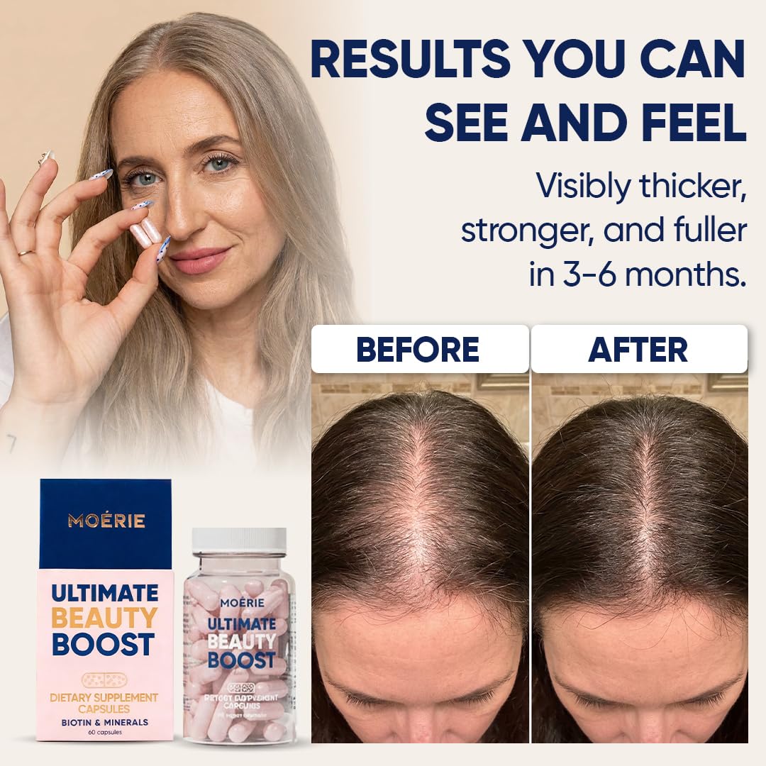 Moerie Hair Boost Supplements for Hair Skin Nails

