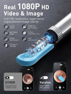 Yorsfun 3-in-1 Ear Wax Removal Kit with Ear Camera

