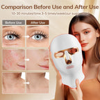Red Light Therapy Face Mask - Cordless LED USB-C Rechargeable

