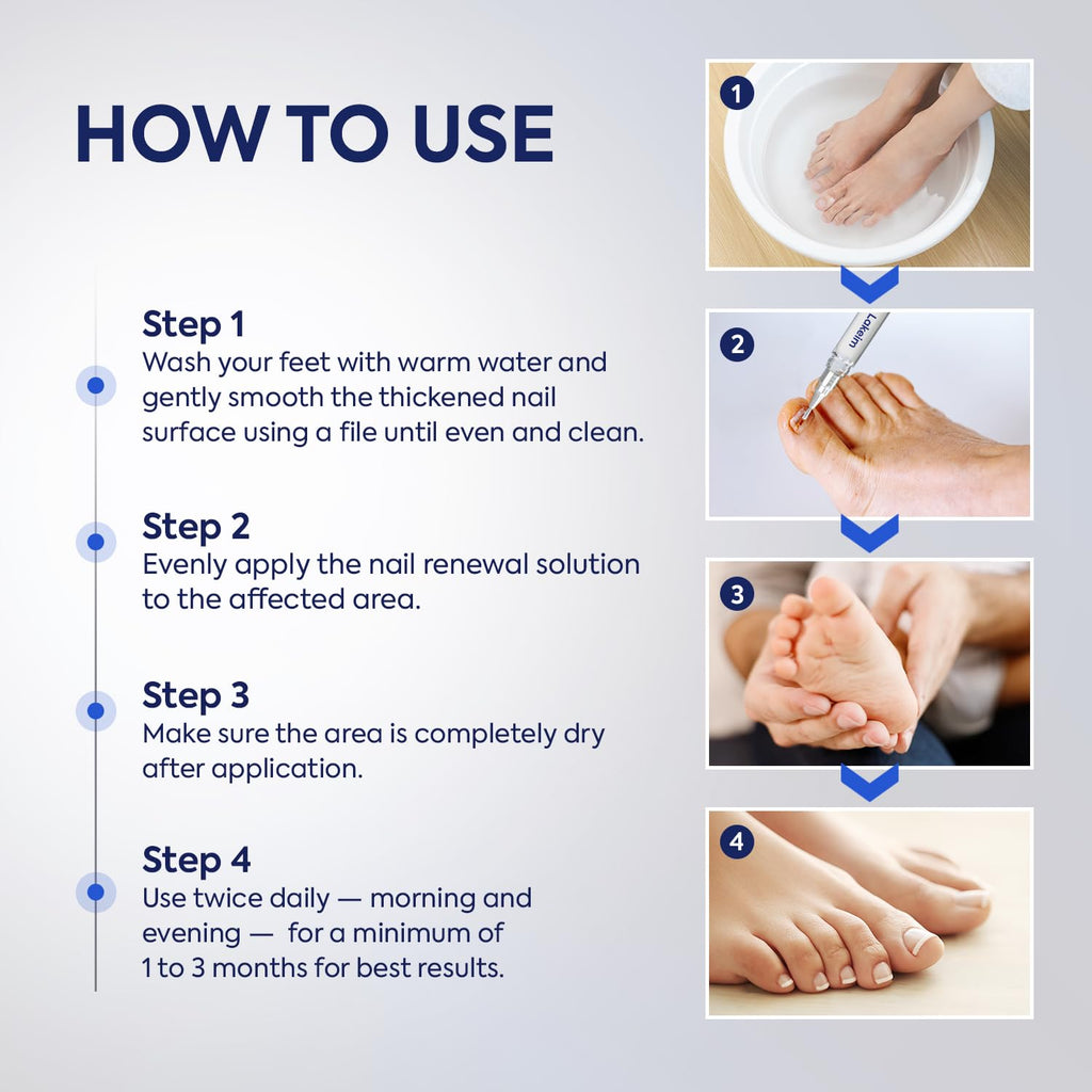 Toenail Fungus Treatment with Undecylenic Acid & Tea Tree

