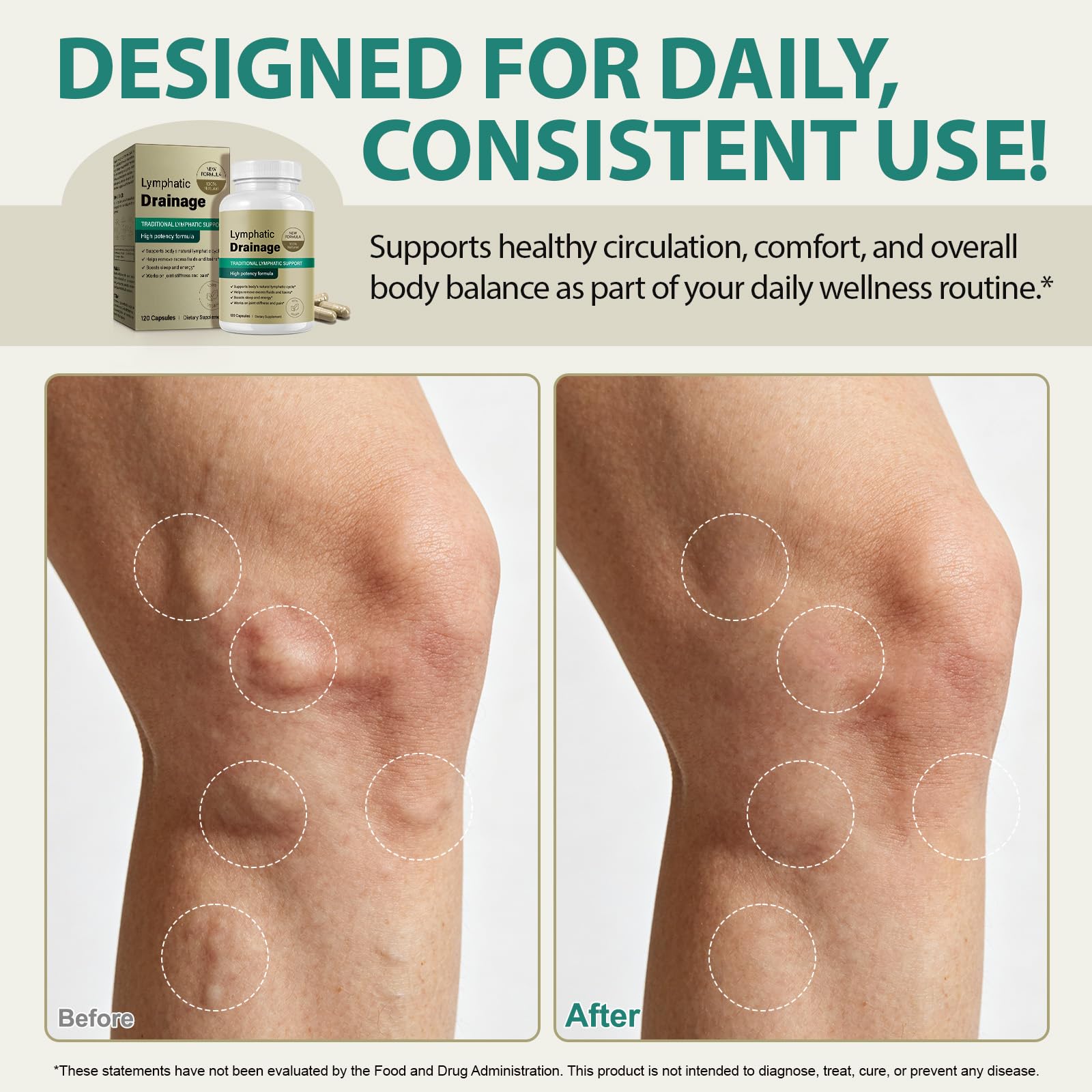 Lymphatic Support Herbal Capsules for Immune & Fluid Balance

