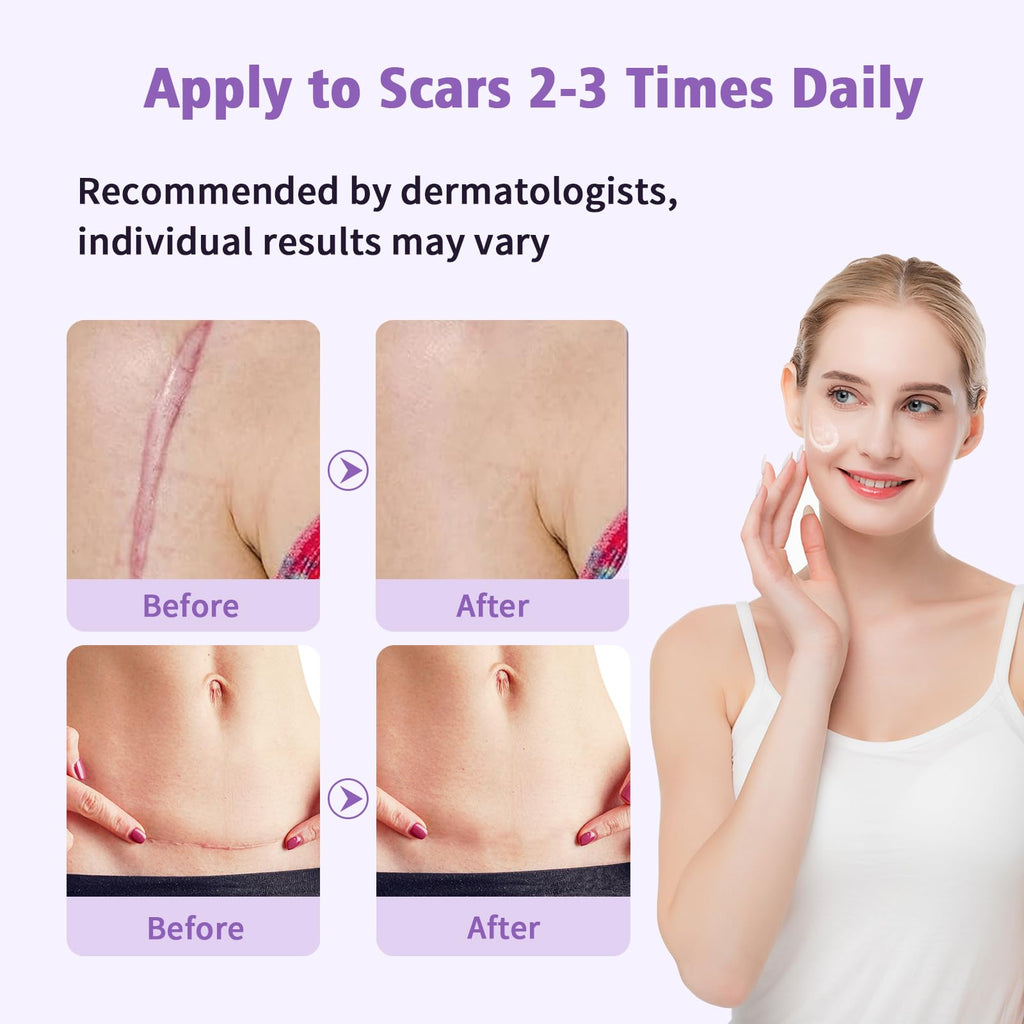 Medical Grade Silicone Scar Gel for Surgical & Acne Scars

