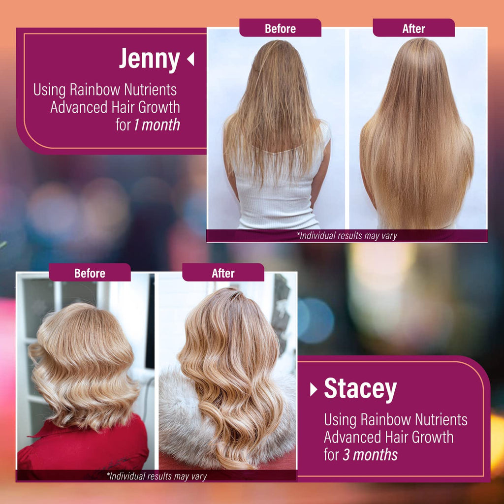 Hair Growth Vitamins for Women by Rainbow Nutrients

