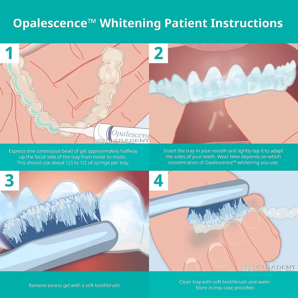 Opalescence Teeth Whitening Gel Refills by Ultradent

