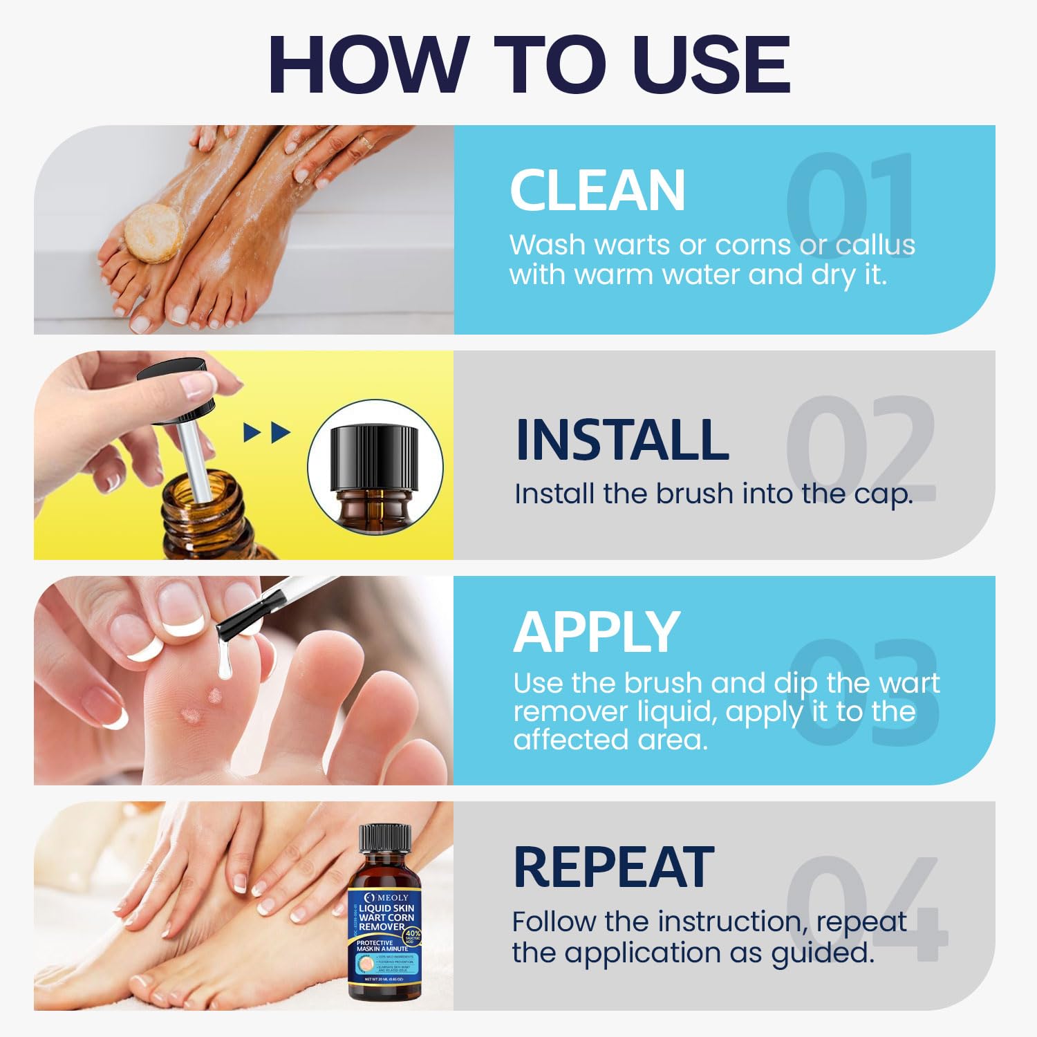 MEOLY Wart Remover - Fast-Acting Maximum Strength

