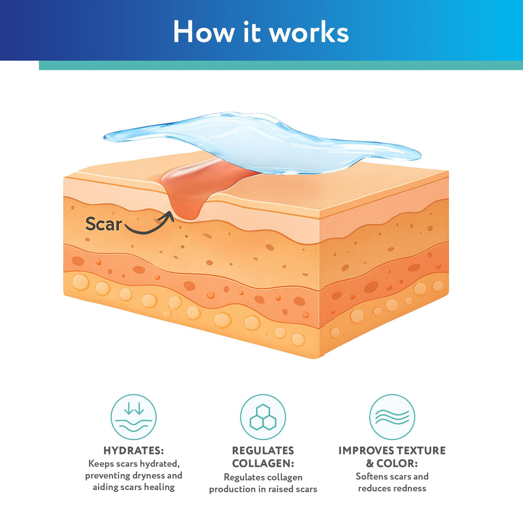 ScarAway Silicone Scar Gel for Hypertrophic & Keloid Scars

