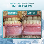 Larineco Nano Hydroxyapatite Remineralizing Gum | Xylitol

