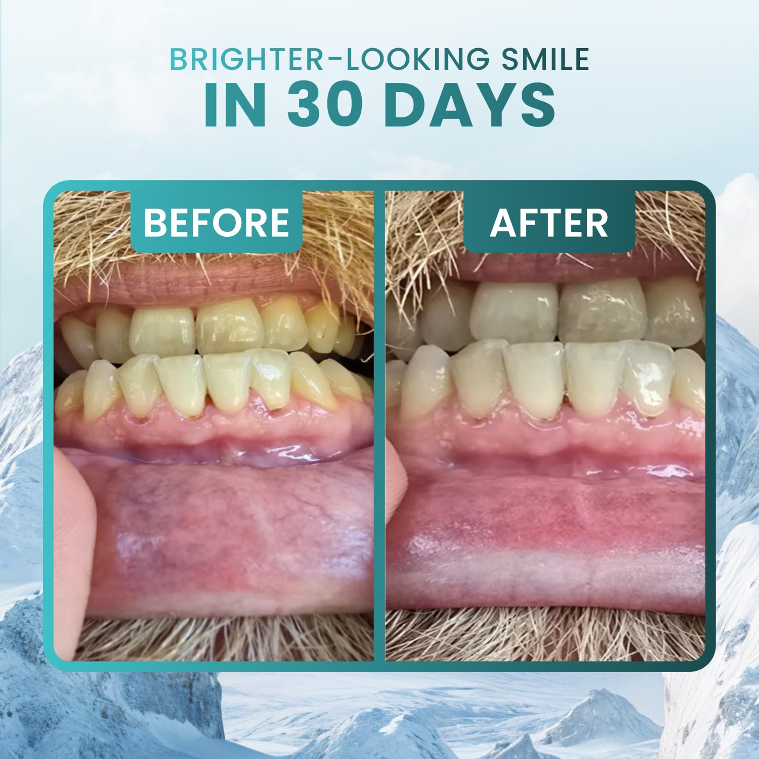 Larineco Nano Hydroxyapatite Remineralizing Gum | Xylitol

