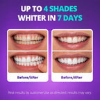 SAKYPRORAL Purple Teeth Whitening Strips - Enamel Safe

