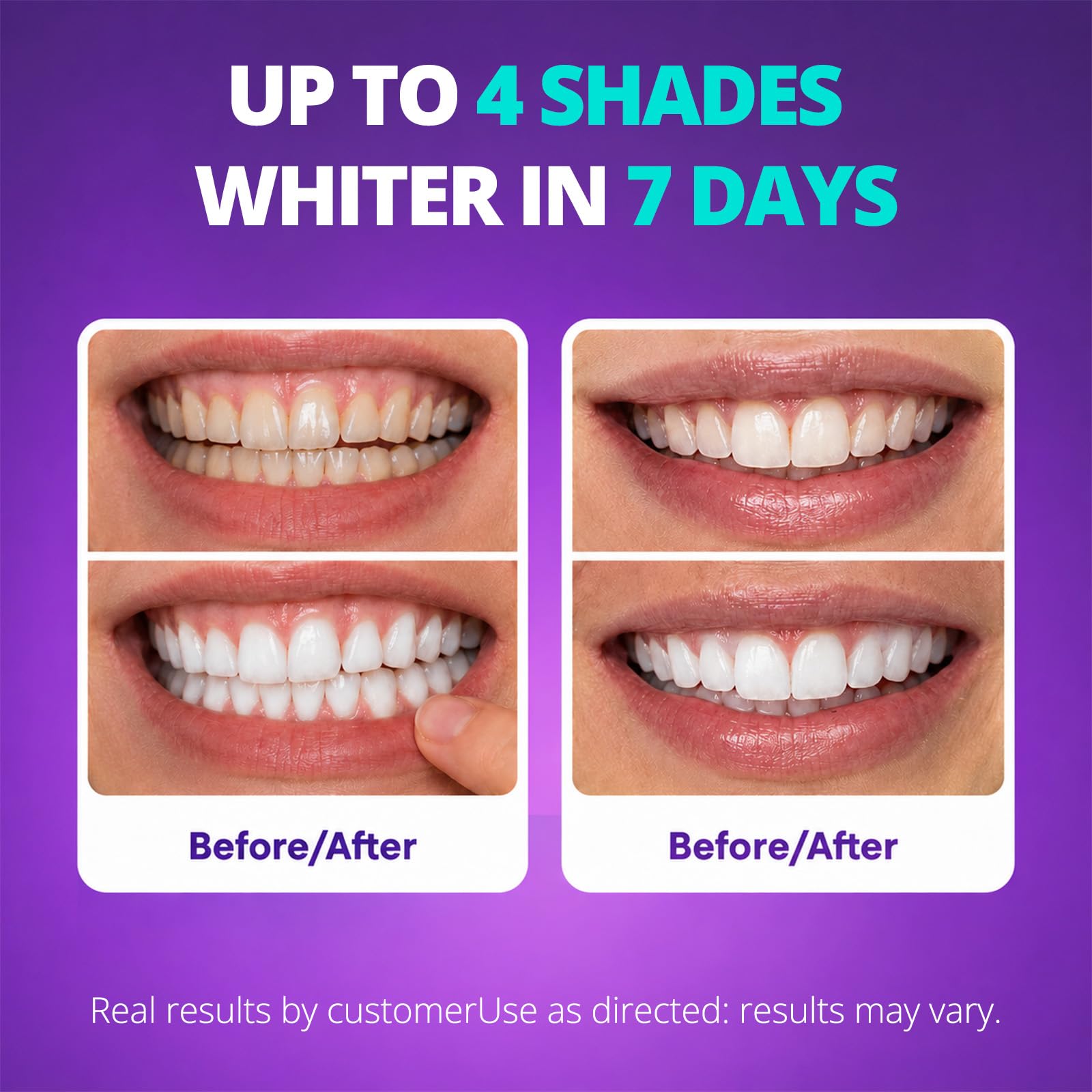 SAKYPRORAL Purple Teeth Whitening Strips - Enamel Safe

