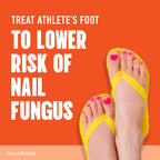 Lotrimin AF Antifungal Treatment for Athlete's Foot

