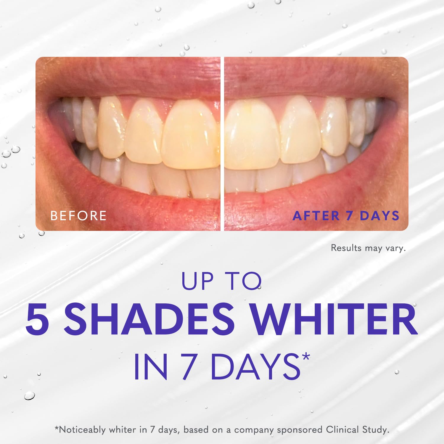 Smileactives Teeth Whitening Kit - At-Home Whitening

