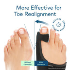 Caretras Bunion Corrector | Toe Alignment & Comfort

