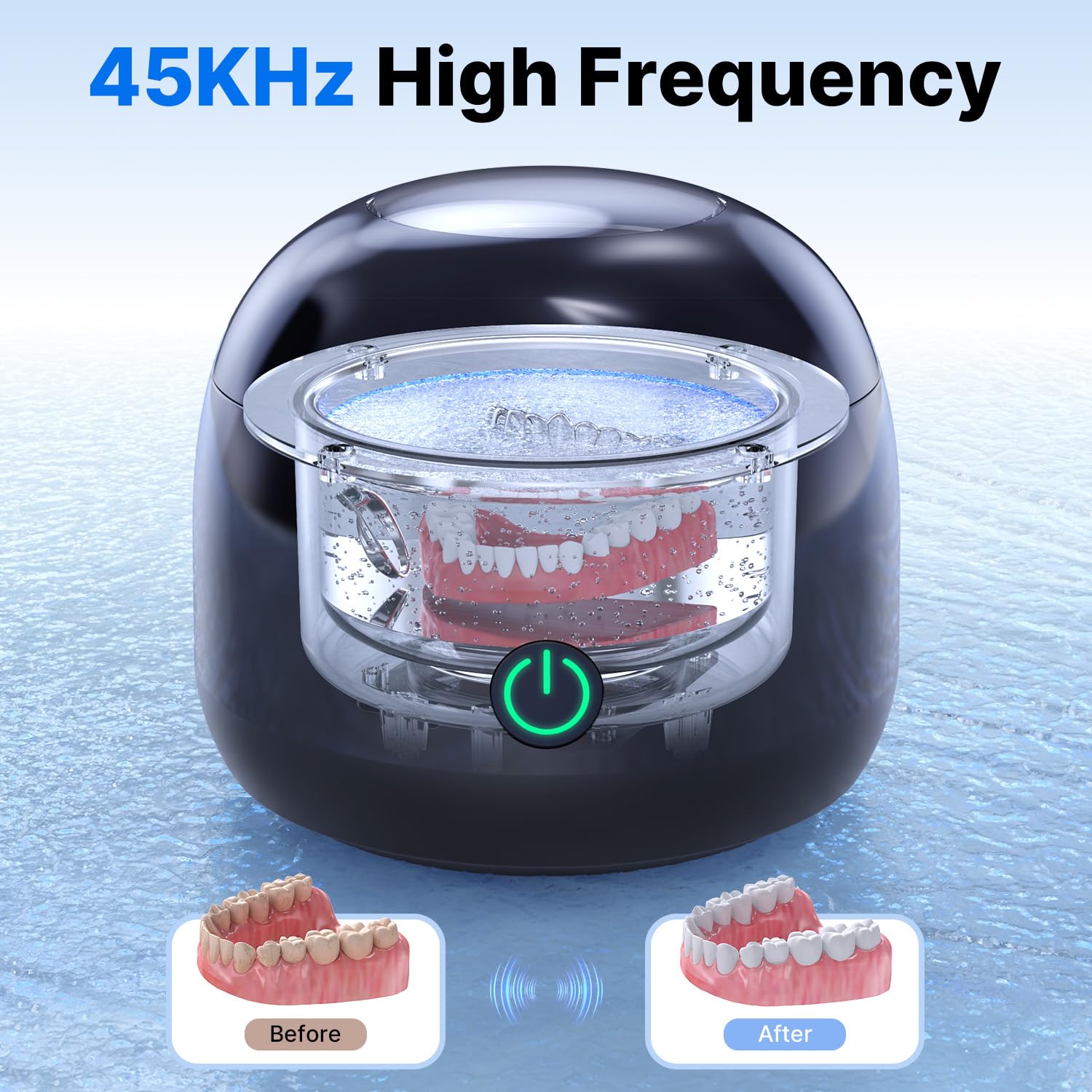 CXRUY Ultrasonic Retainer Cleaner - 45KHz Dental Cleaner

