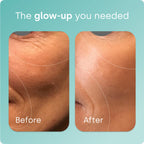 Biosil Collagen Booster with Patented ch-OSA

