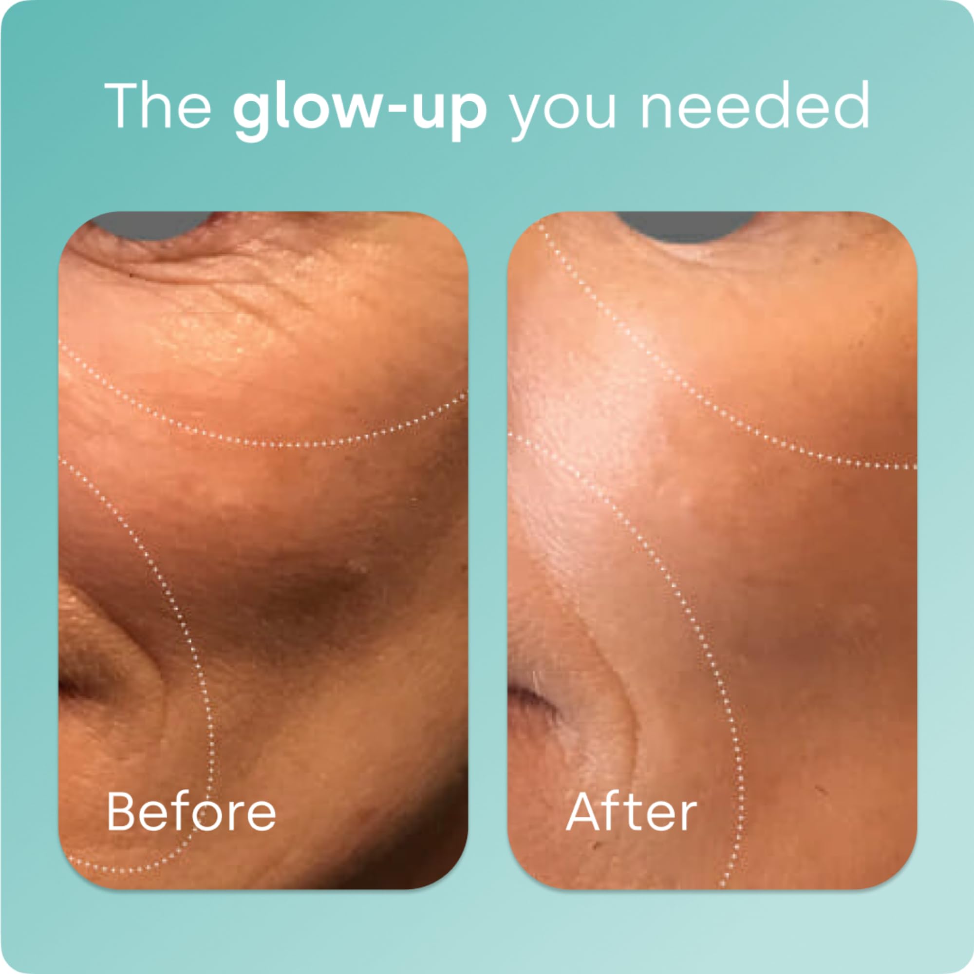 Biosil Collagen Booster with Patented ch-OSA

