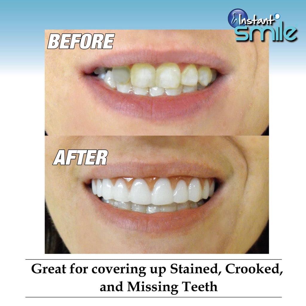 Instant Smile Cosmetic Teeth

