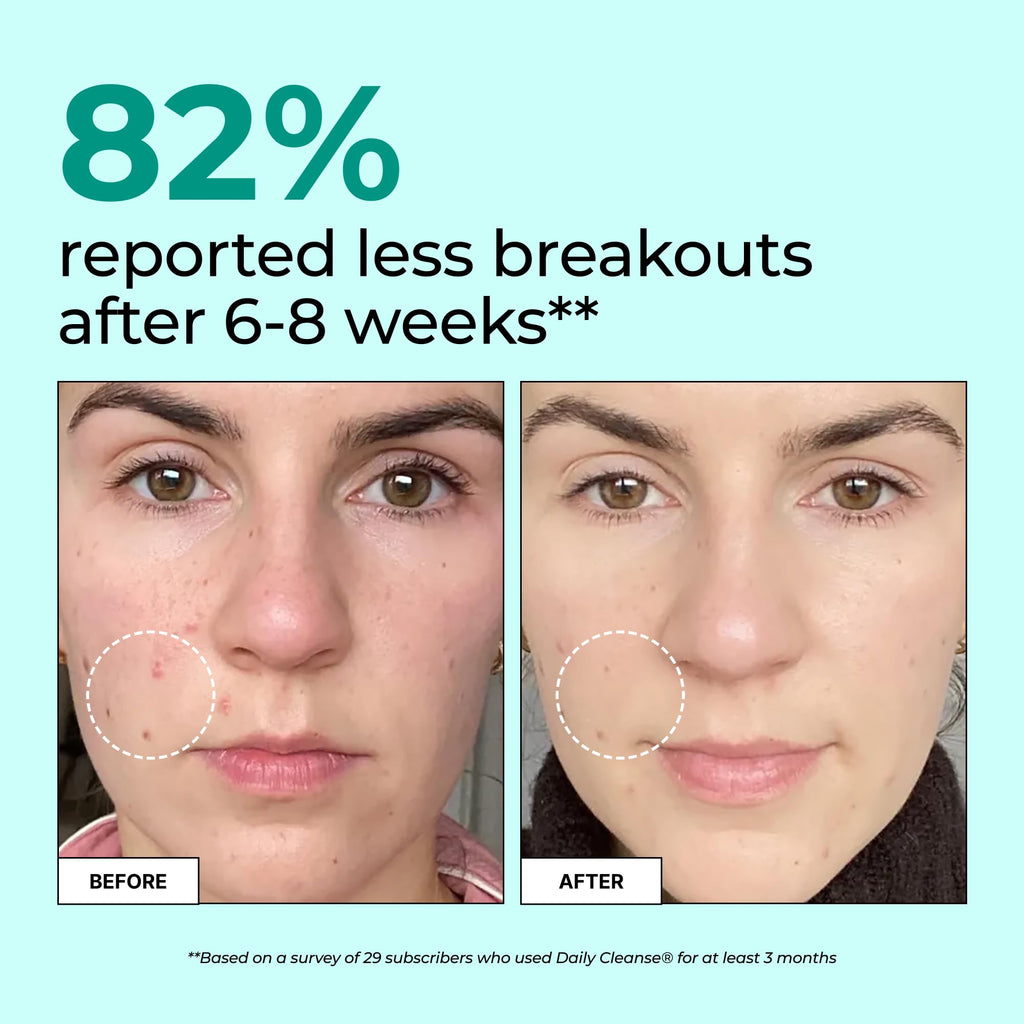 HUM Daily Cleanse Acne Supplements | Clear Skin

