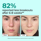 HUM Daily Cleanse Acne Supplements | Clear Skin

