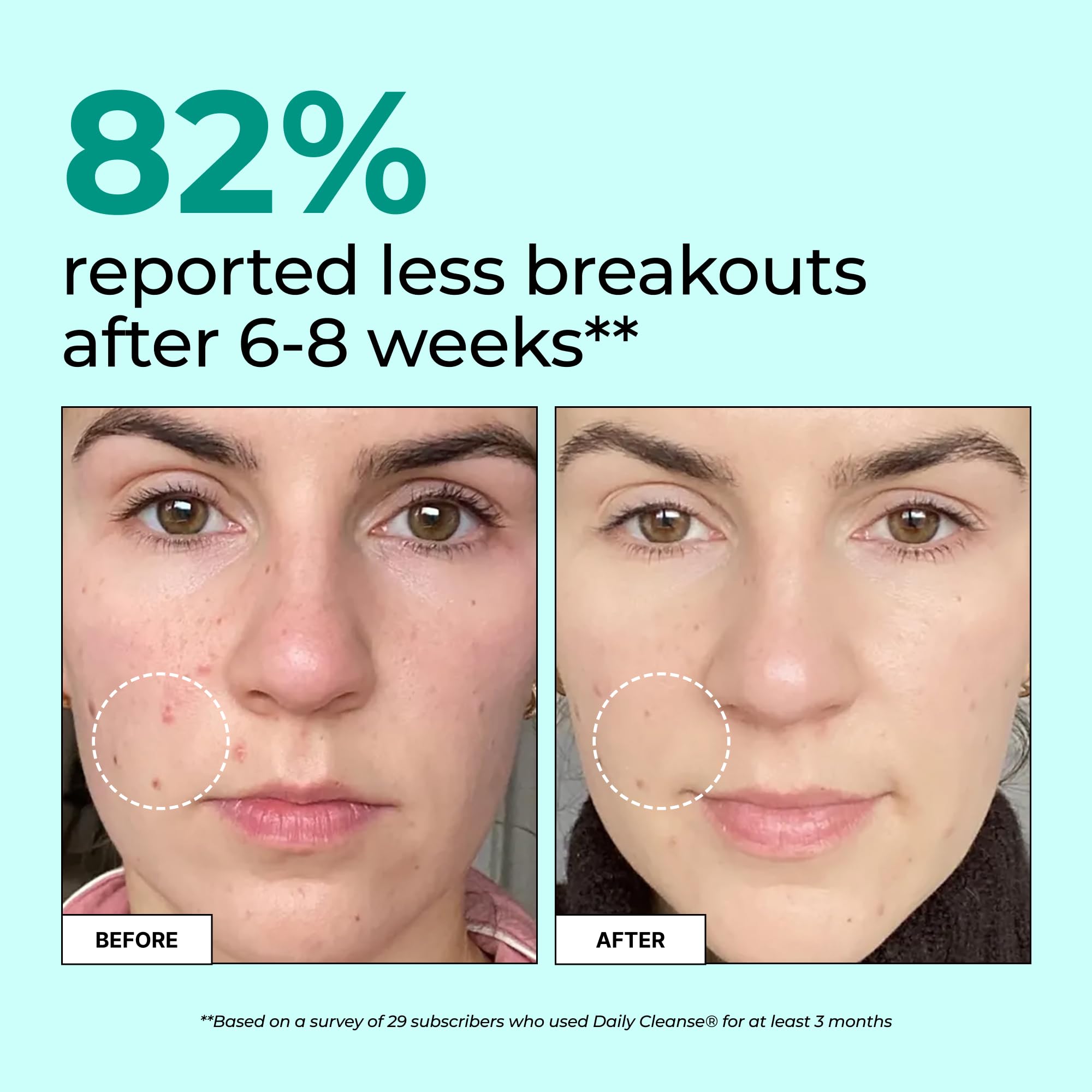 HUM Daily Cleanse Acne Supplements | Clear Skin

