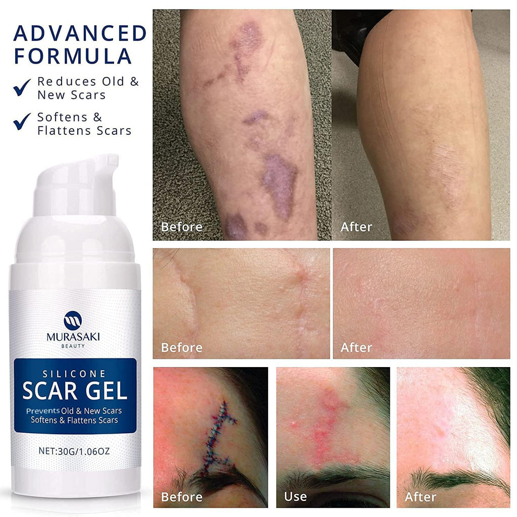 Silicone Scar Gel by Murasaki Beauty for Surgical Scars

