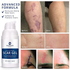 Silicone Scar Gel by Murasaki Beauty for Surgical Scars

