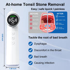 Tonsil Stone Remover Tool LED Light & 11 Probes

