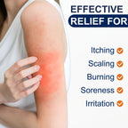 Antifungal Cream Kerova 2% Miconazole for Jock Itch

