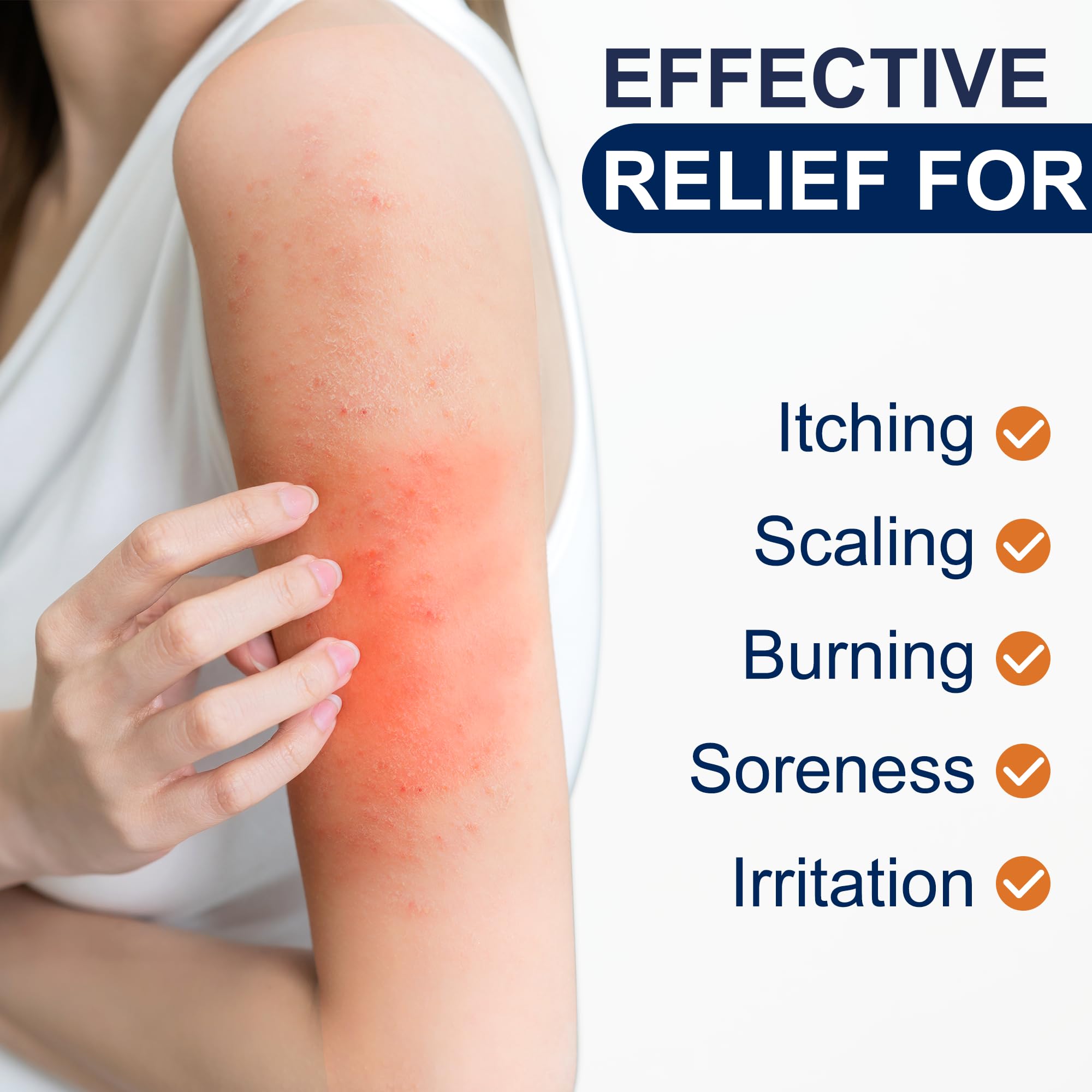 Antifungal Cream Kerova 2% Miconazole for Jock Itch

