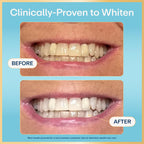 Lumineux 2-in-1 Whitening Pen | Enamel Safe

