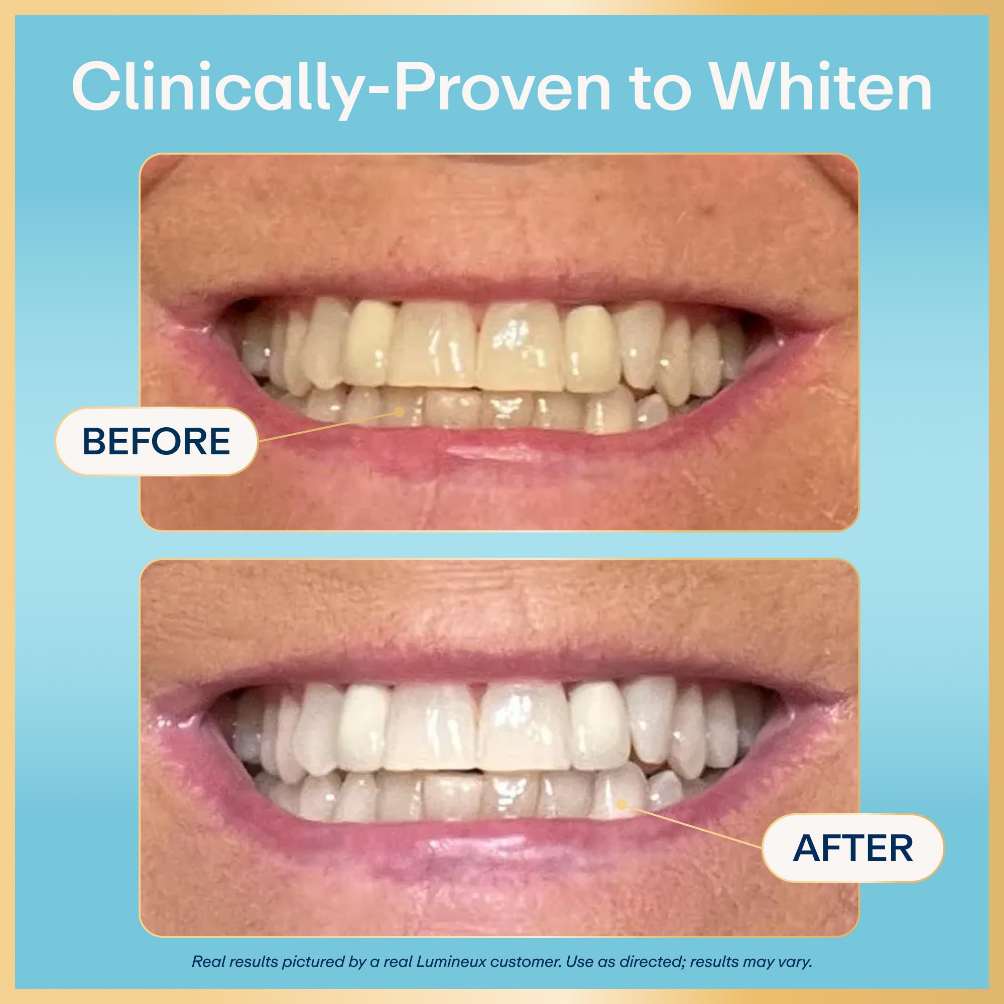 Lumineux 2-in-1 Whitening Pen | Enamel Safe

