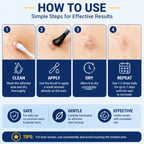 DVO Wart Remover Liquid Maximum Strength Fast-Acting

