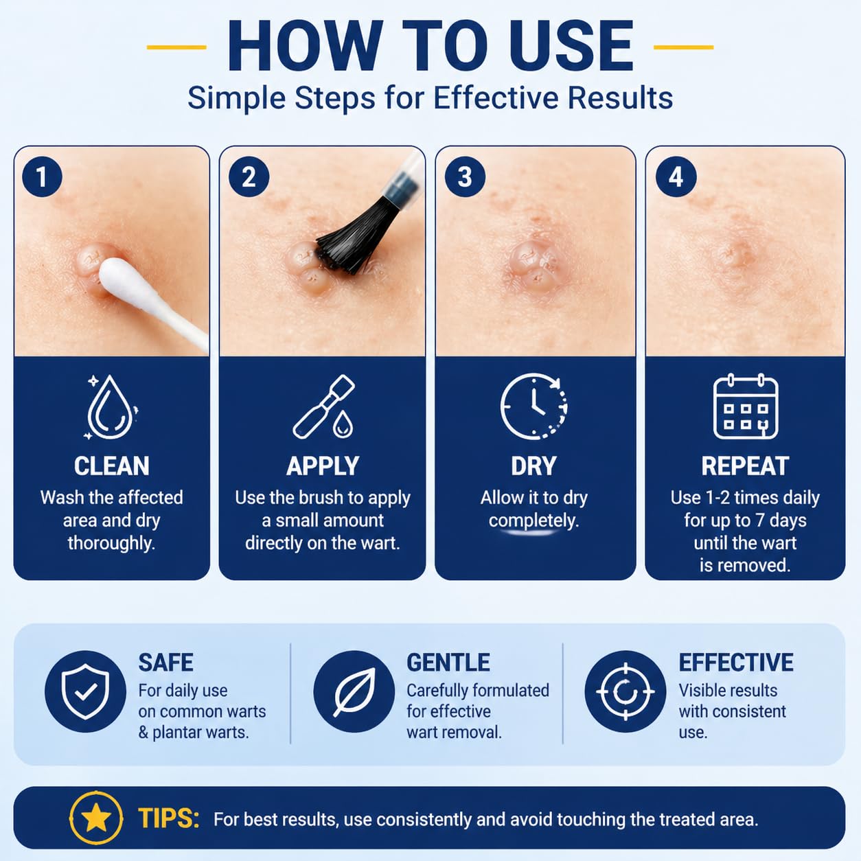 DVO Wart Remover Liquid Maximum Strength Fast-Acting


