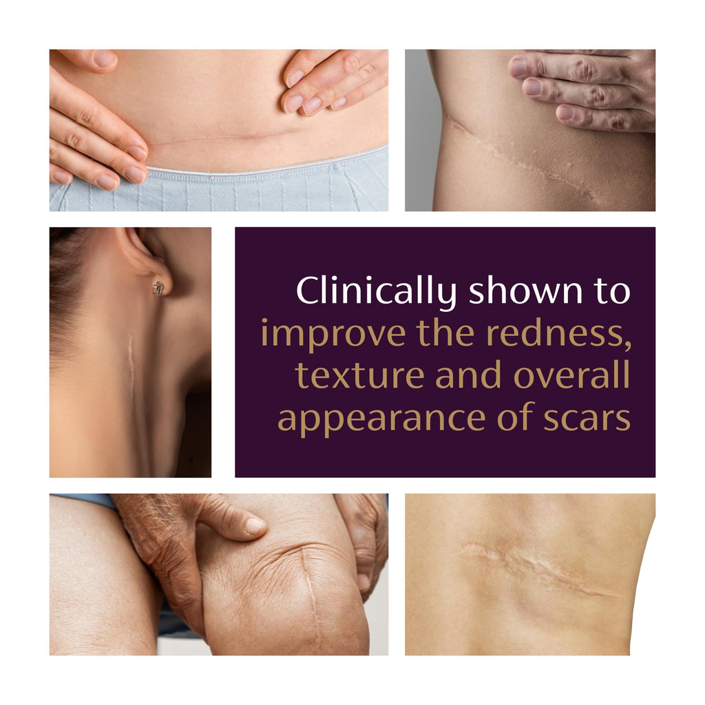 Mederma Advanced Scar Gel for Old & New Scars

