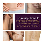 Mederma Advanced Scar Gel for Old & New Scars

