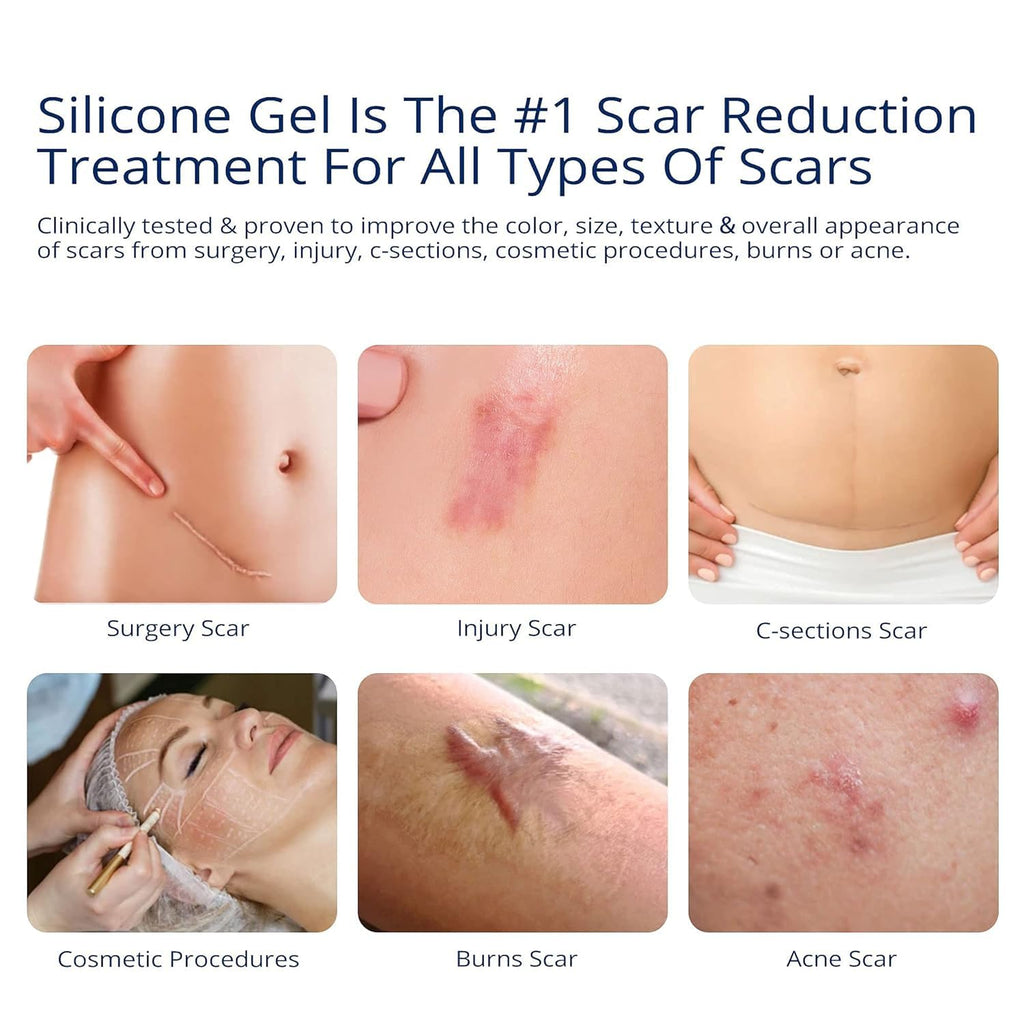 Silicone Scar Gel by Murasaki Beauty for Surgical Scars


