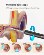 BEBIRD R1 Ear Wax Removal Tool with 1080P Camera EarScope

