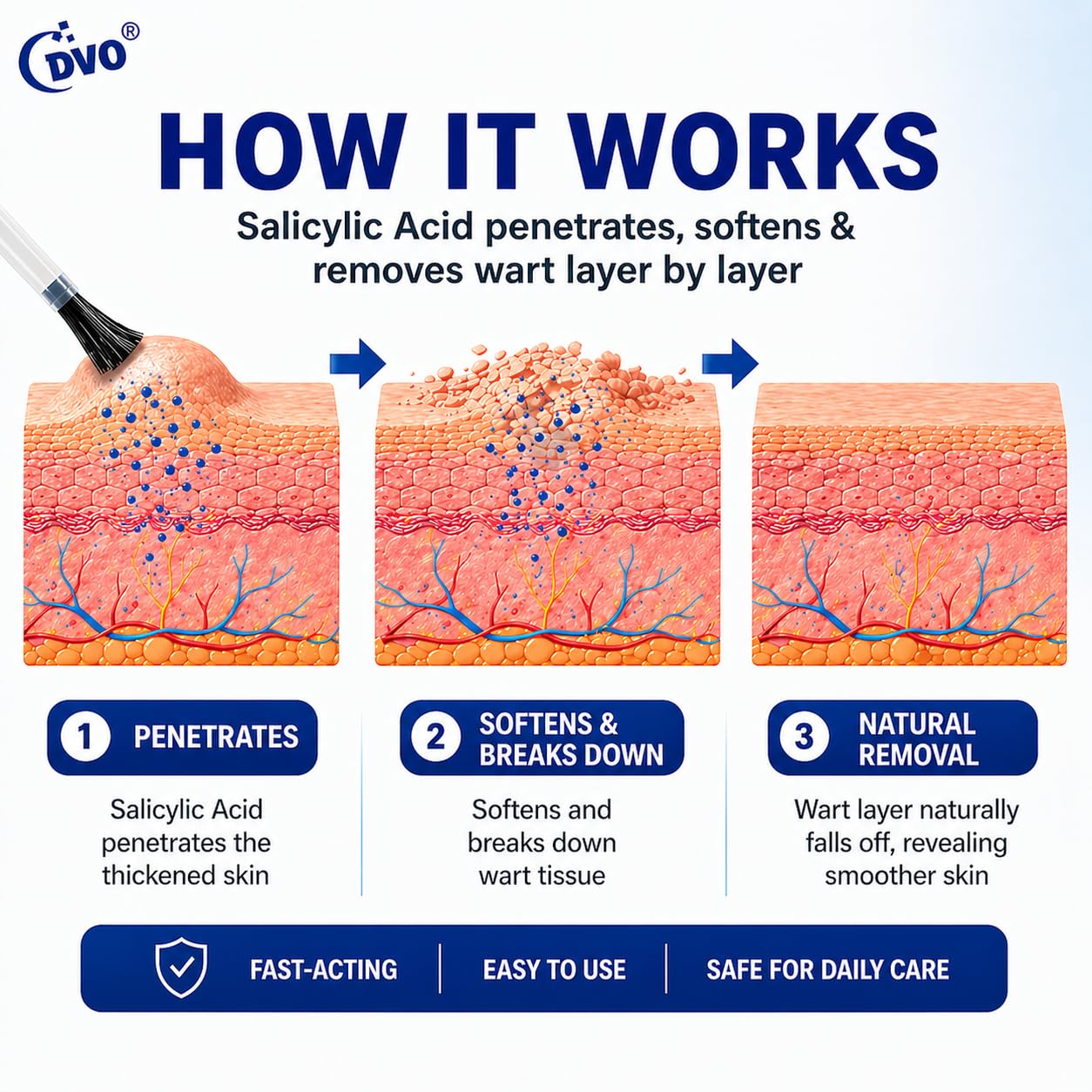 DVO Wart Remover Liquid Maximum Strength Fast-Acting

