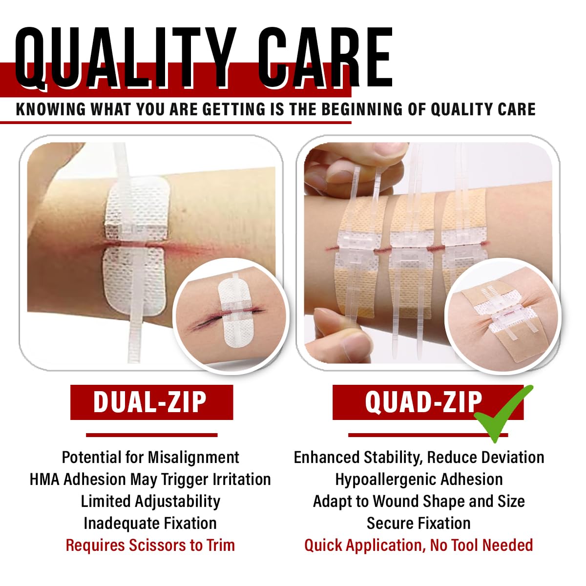 EVERLIT Wound Closure System | Suture-Free Zip-Stitch

