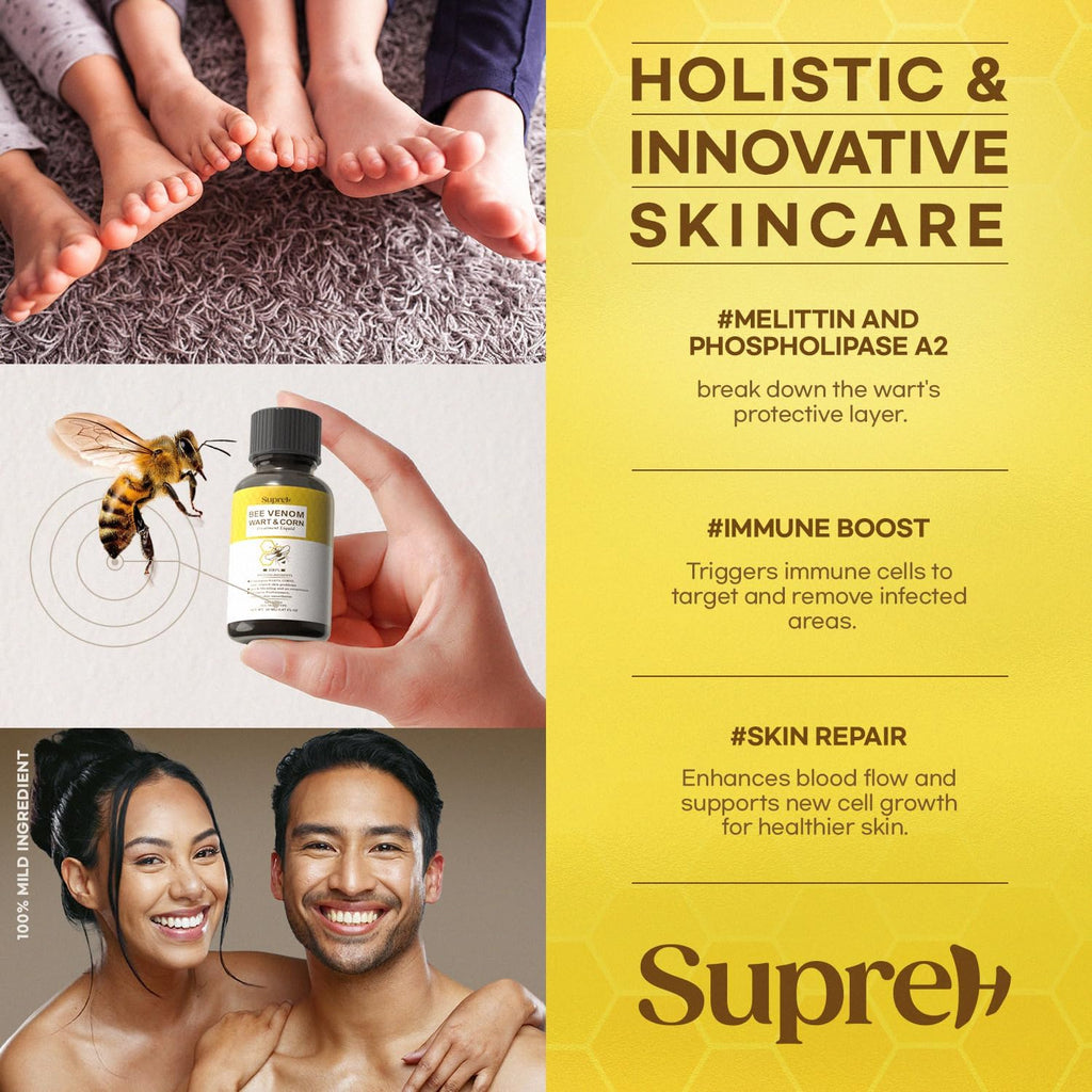 SupreH Bee Venom Wart Remover with Salicylic Acid

