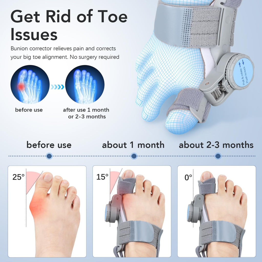 Bunion Corrector with Adjustable Knob for Toe Alignment


