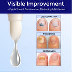 Nail Care Solution Kit for Thick Brittle Nails

